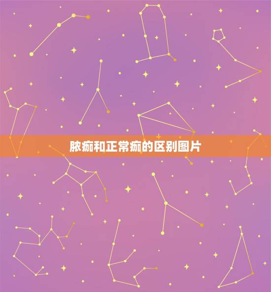 脓痂和正常痂的区别图片,伤口结的脓痂怎么办? 脓痂和正常痂的区别图片,伤口结的脓痂怎么办?