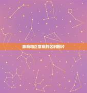 脓痂和正常痂的区别图片，伤口结的脓痂怎么办？